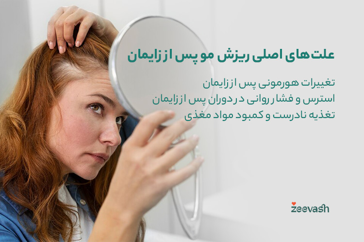 دلایل اصلی ریزش مو پس از زایمان